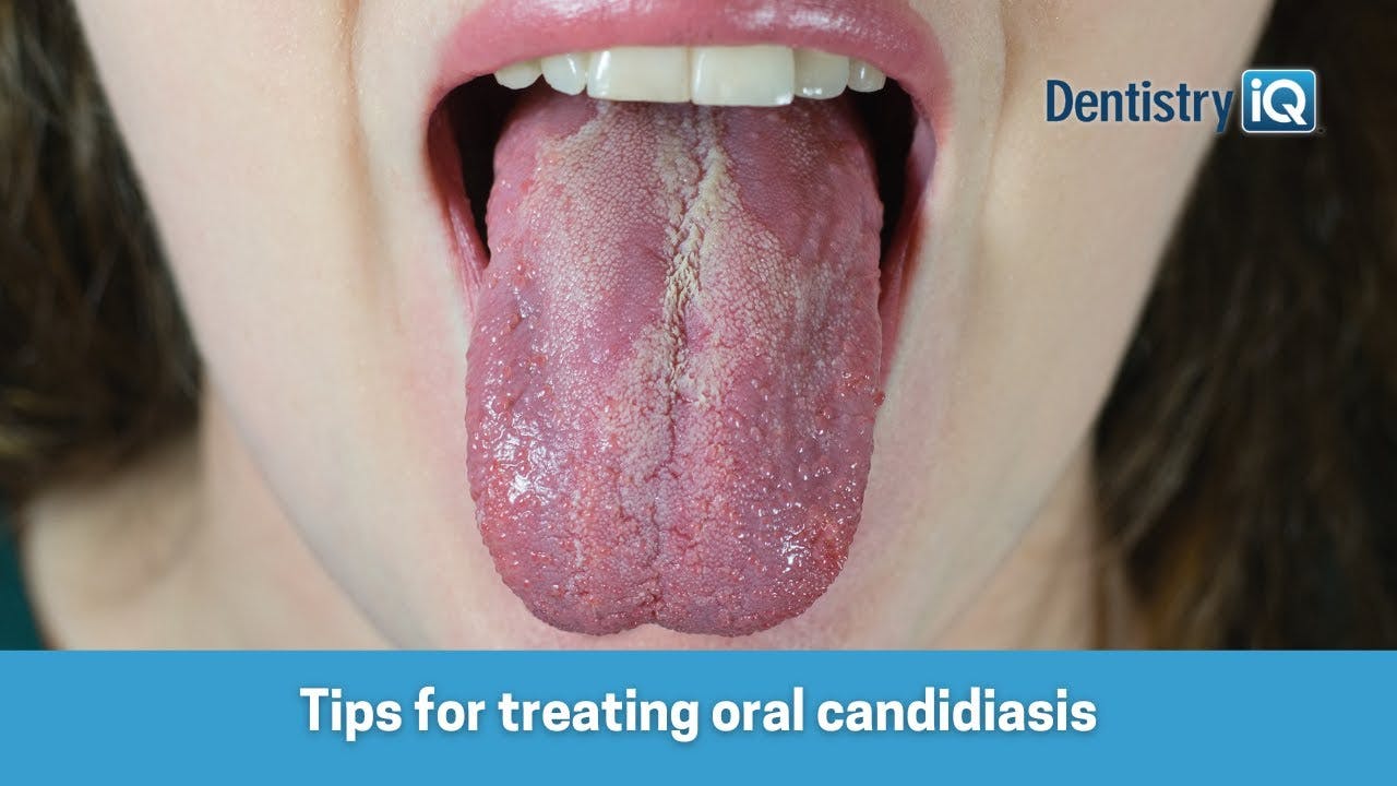 678fc68799b90373f4e26bd4 Maxresdefault