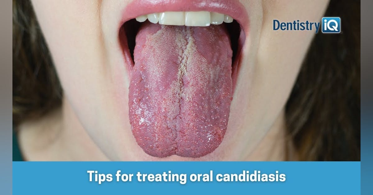 juno tutilishi jinsiy aloqa Haqiqiy hayot porno filmlar