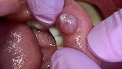 oral pathology oral pathology