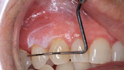 oral pathology oral pathology