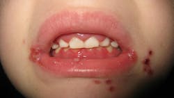 oral pathology oral pathology