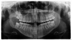 oral pathology oral pathology