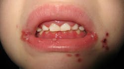 oral pathology oral pathology