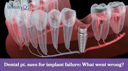 Patient taking bisphosphonates sues dentist for implant failure