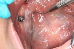 oral pathology in dentistry oral pathology in dentistry