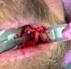 oral pathology ini dentistry oral pathology ini dentistry