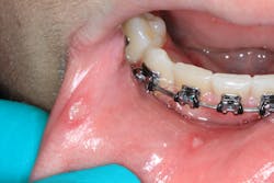 oral pathology in dentistry oral pathology in dentistry