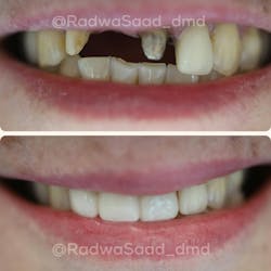 cosmetic dentistry cosmetic dentistry