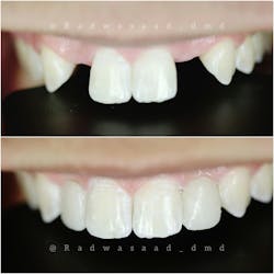 cosmetic dentistry cosmetic dentistry