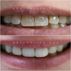 cosmetic dentistry cosmetic dentistry