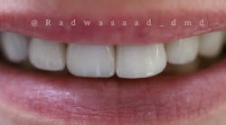 cosmetic dentistry cosmetic dentistry