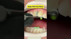 How to use Filtek Easy match for quick shade matching on anterior composites How to use Filtek Easy match for quick shade matching on anterior composites