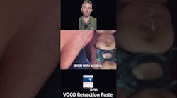 How to end retraction cord hassles How to end retraction cord hassles