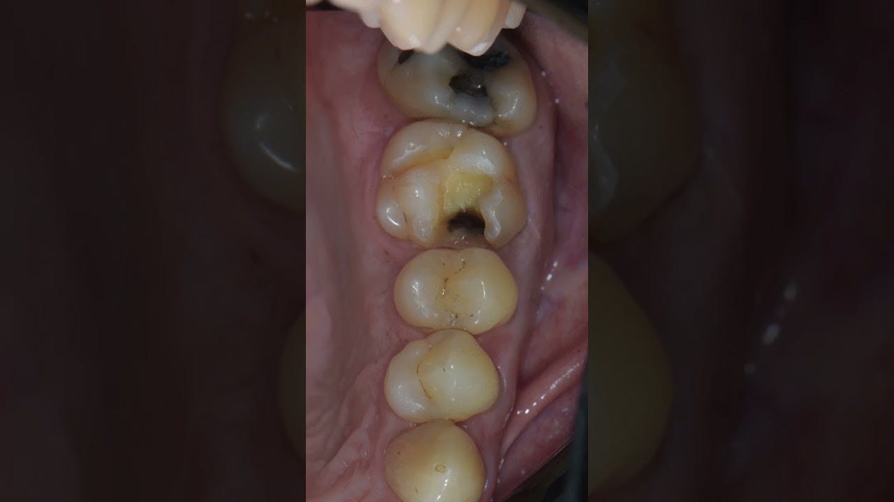 67c712790cf17c617e783f6f Maxresdefault