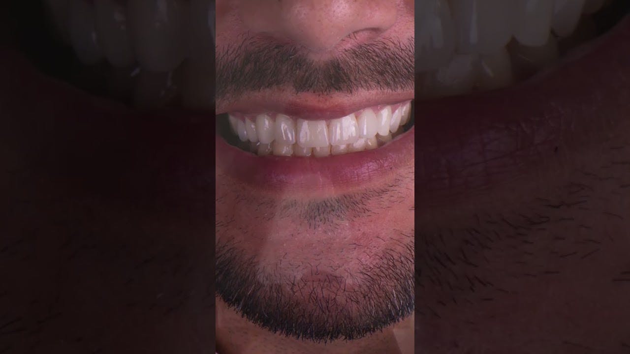 Happy 20th anniversary, Ivoclar e