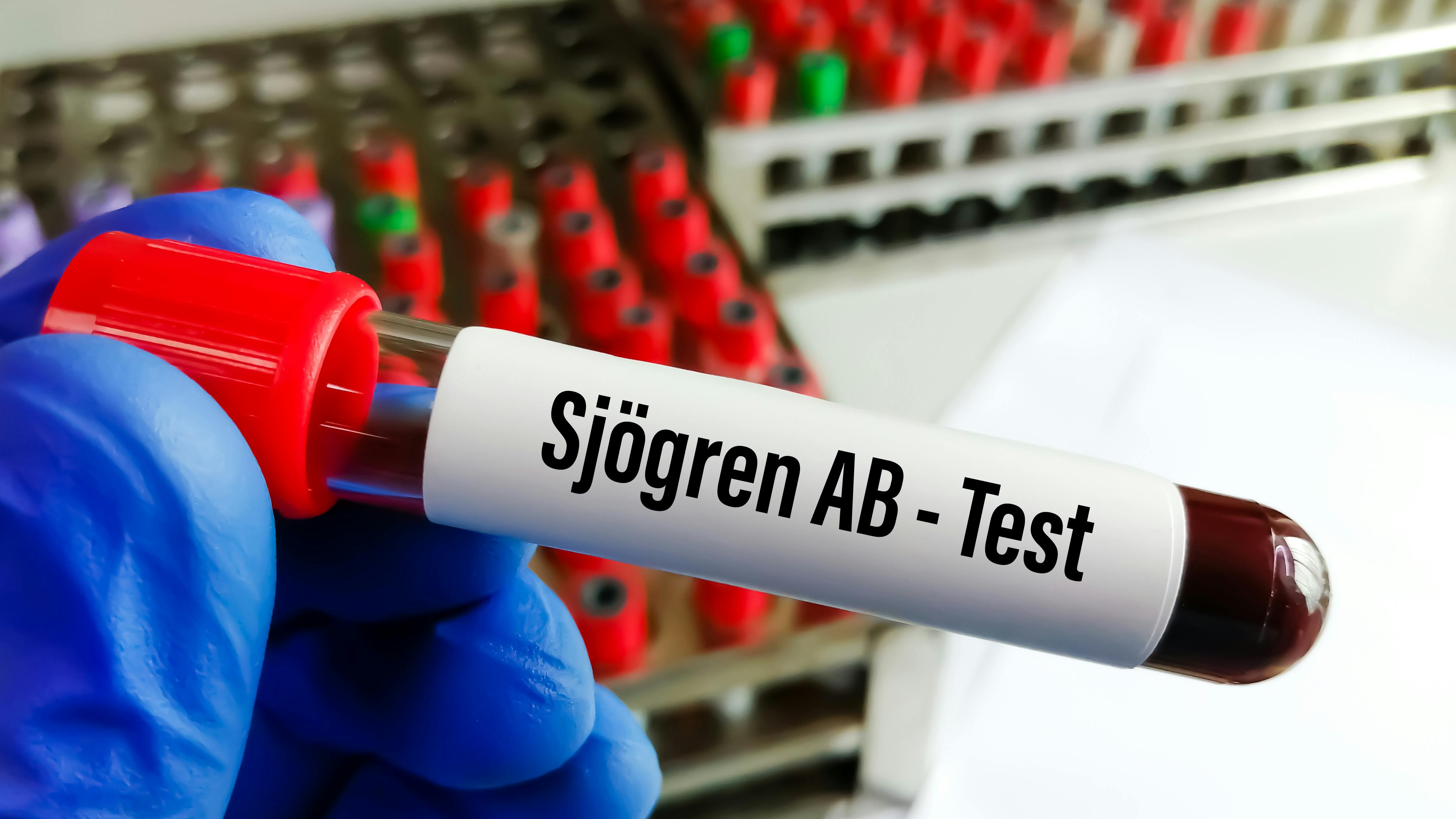 sjogren's syndrome and oral-systemic health