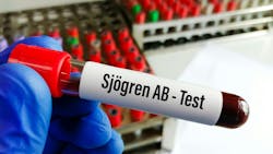 sjogren's syndrome and oral-systemic health sjogren's syndrome and oral-systemic health