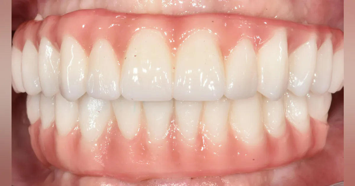 A digital revolution in dentistry A digital revolution in dentistry