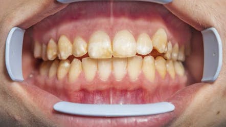 681a25dbee96ba94f8fbc60c Screenshot 20250506 At 10