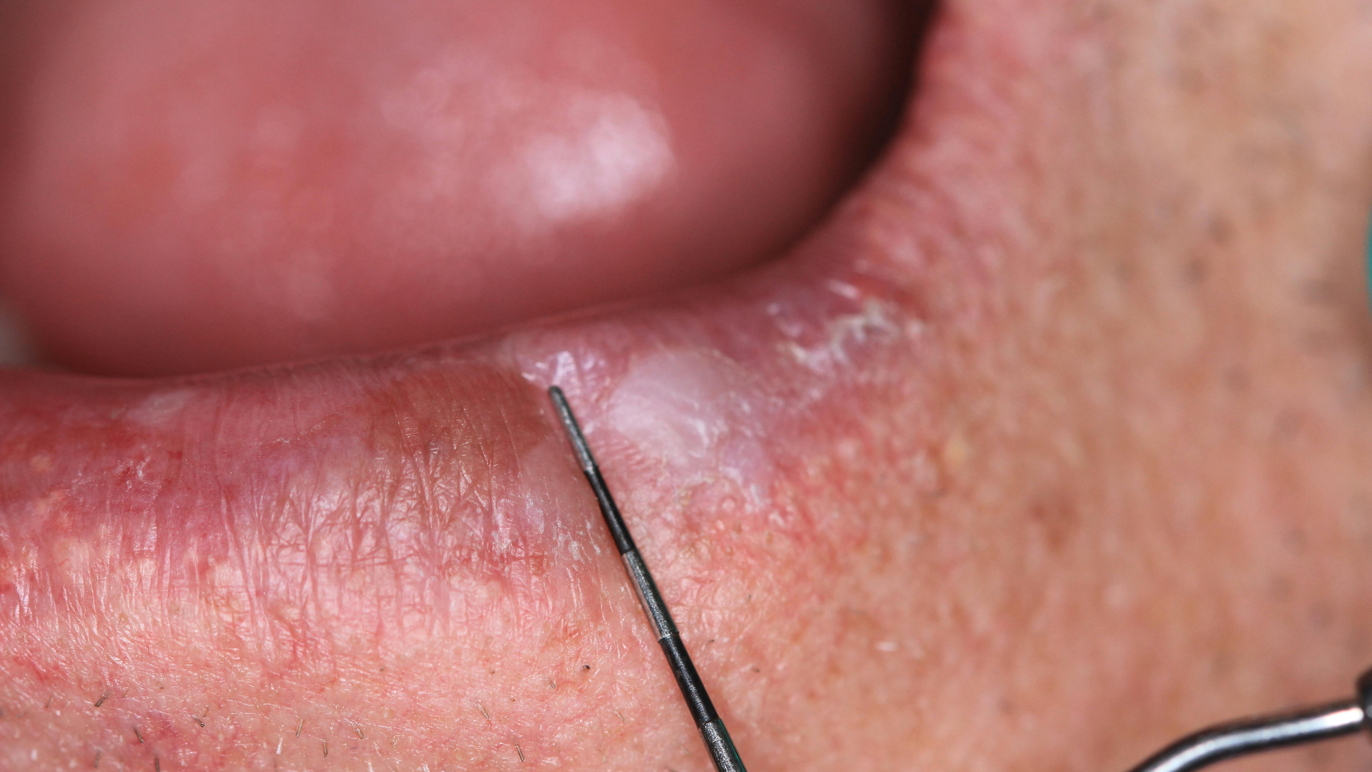 oral pathology reference