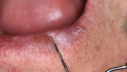 oral pathology reference oral pathology reference