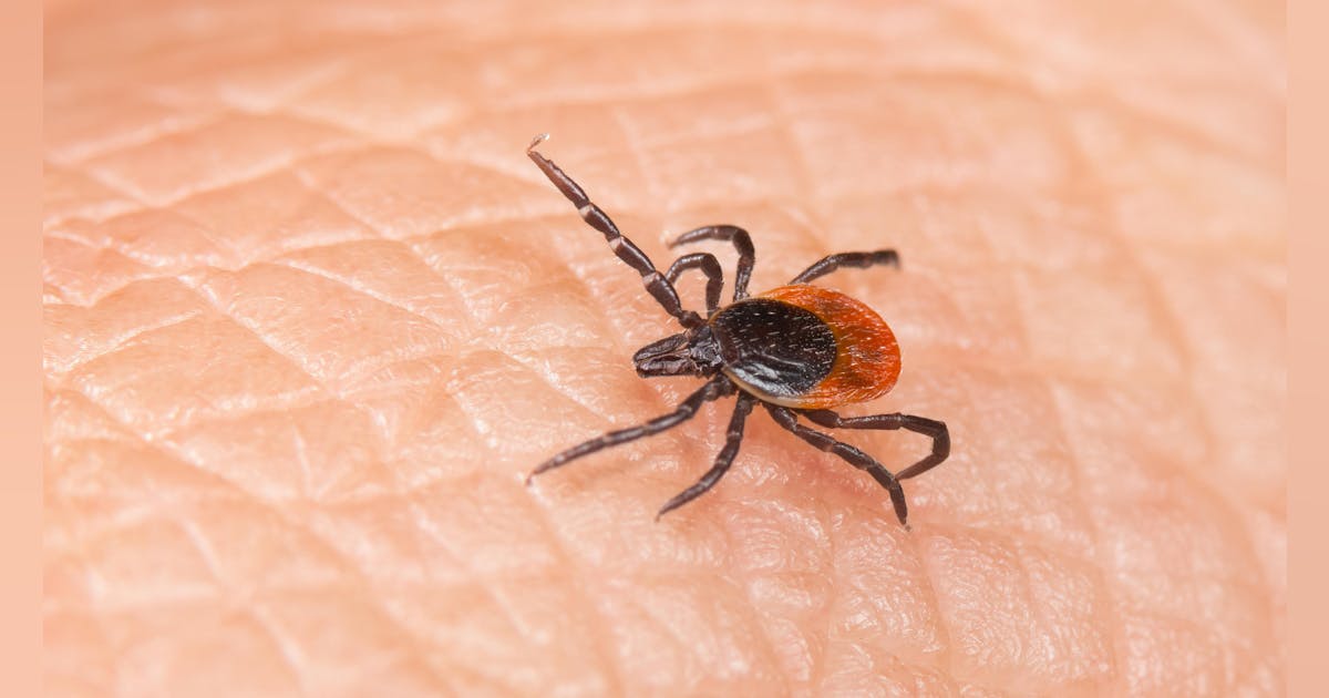 New research links tick bite allergy to ingredients in common dental products