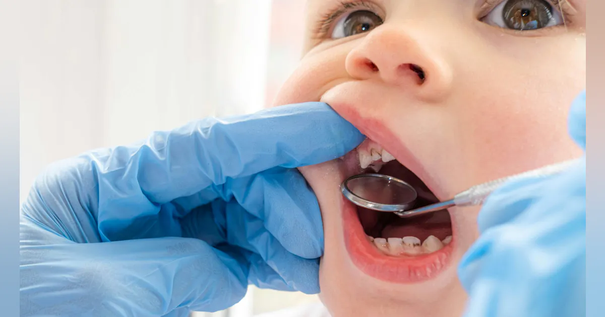 New study projects economic and oral health effects of fluoride removal New study projects economic and oral health effects of fluoride removal