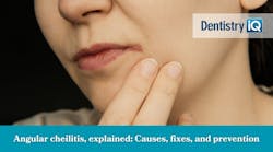 Angular cheilitis, explained: Causes, fixes, and prevention Angular cheilitis, explained: Causes, fixes, and prevention