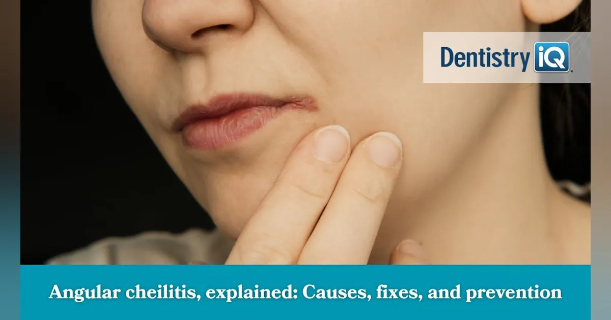 Angular cheilitis, explained: Causes, fixes, and prevention | Dentistry IQ