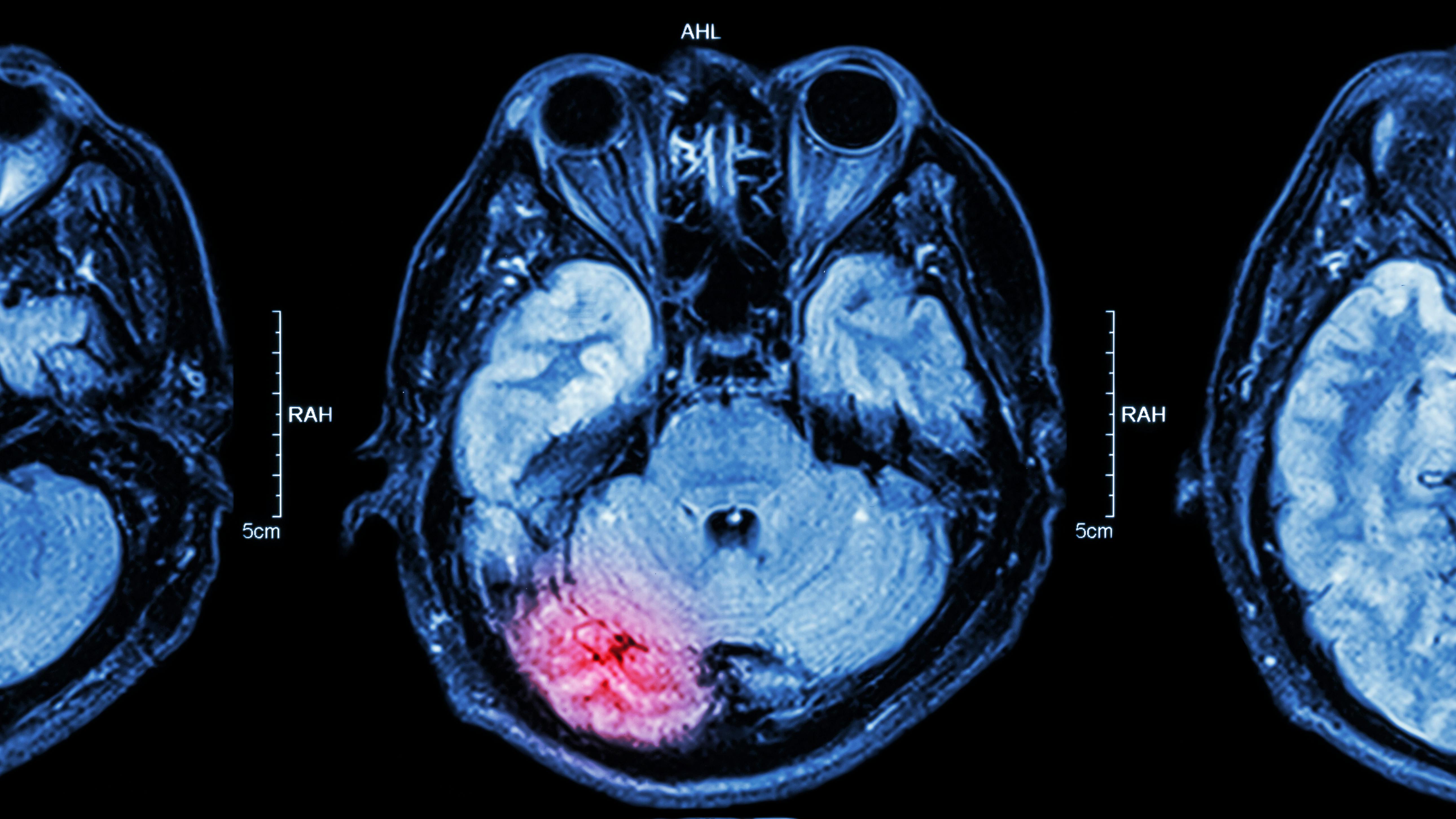 690e3074705c11a0adb2feff Gettyimages535910165