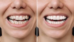 69139626f717d381422746bf Gettyimages1522411950 69139626f717d381422746bf Gettyimages1522411950