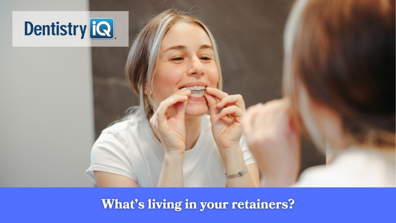 What&rsquo;s living in your retainers?