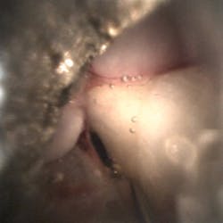 image of teeth made from a dental endoscope image of teeth made from a dental endoscope