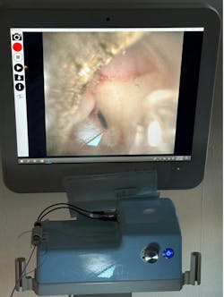 a dental endoscope a dental endoscope