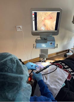 a dental professional using a dental endoscope a dental professional using a dental endoscope