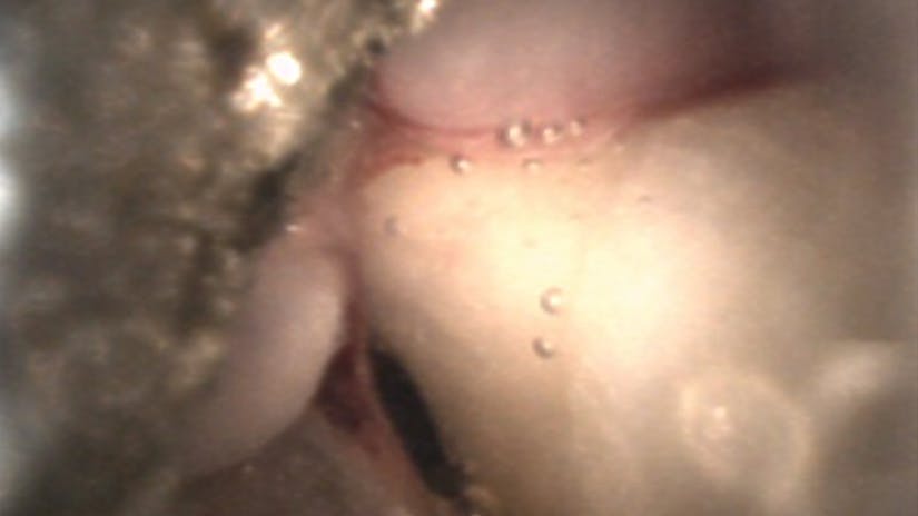 image from a dental endoscope