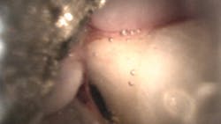 image from a dental endoscope image from a dental endoscope