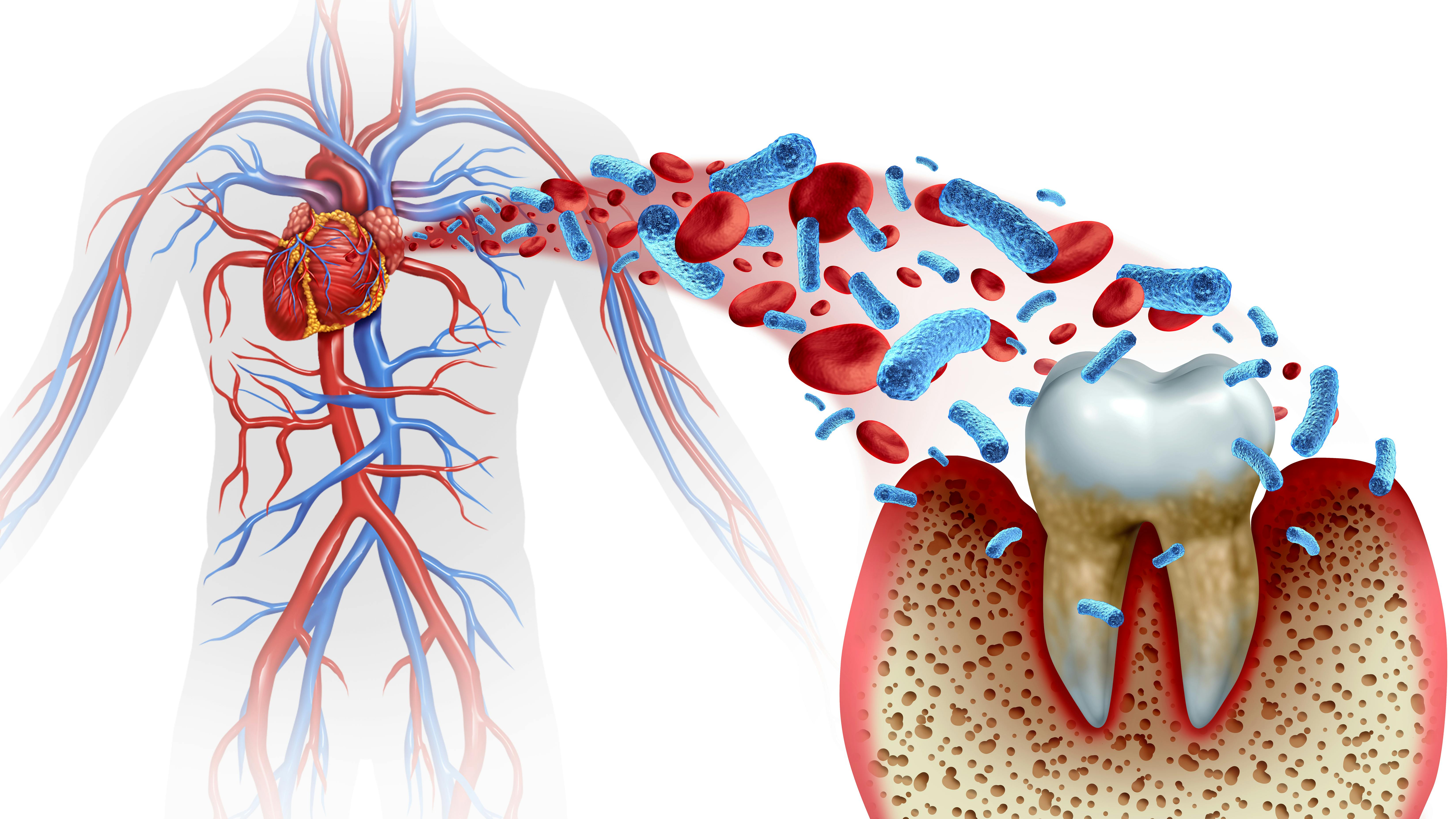 illustration of the cardiovascular system and a tooth, indicating the oral-systemic connection