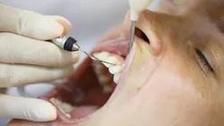 hygienist using instruments to clean a patient's teeth