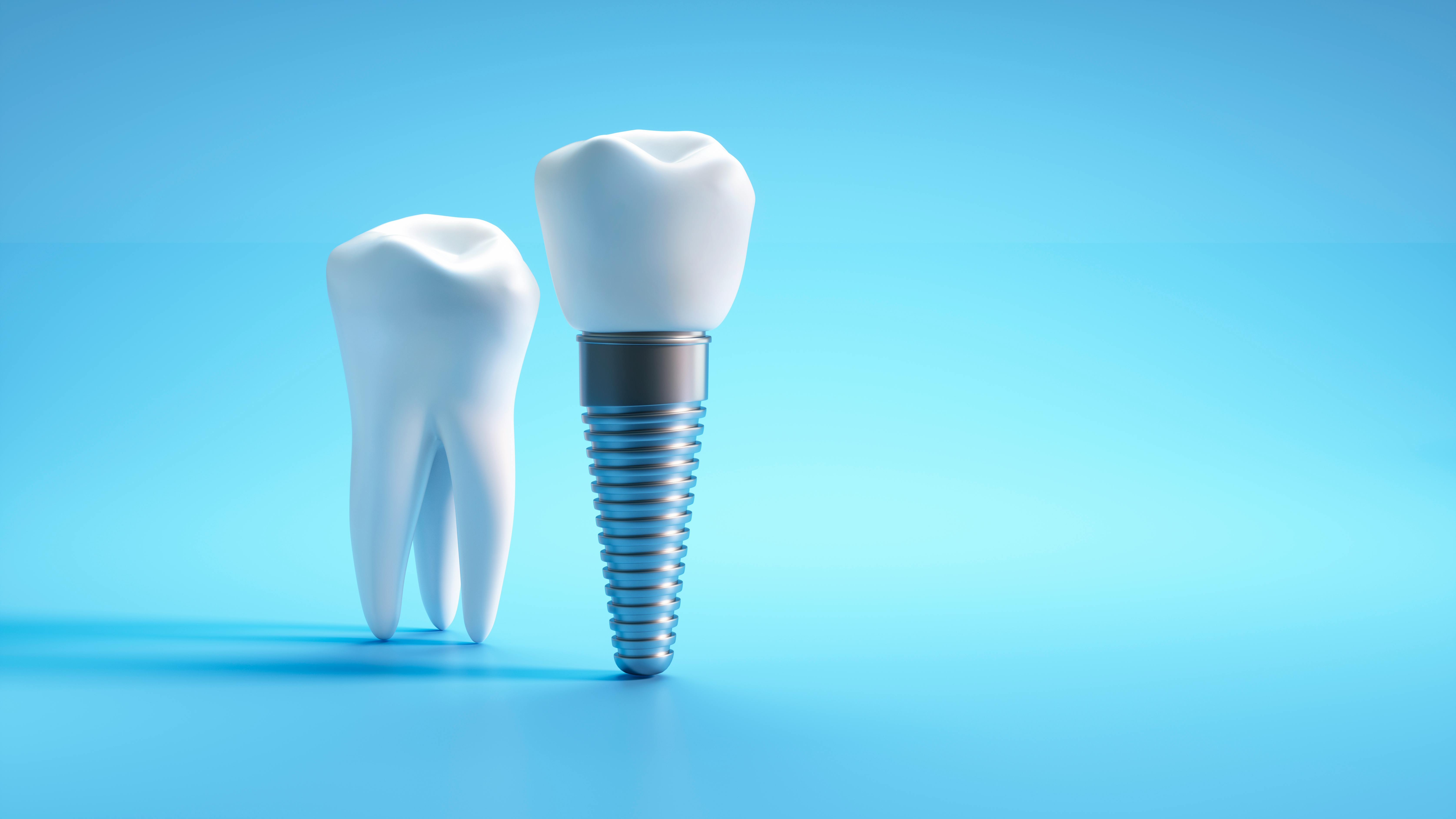 a. molar tooth and a dental implant on a blue background