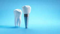 a. molar tooth and a dental implant on a blue background